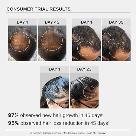 Bare Anatomy Advanced Hair Growth Serum