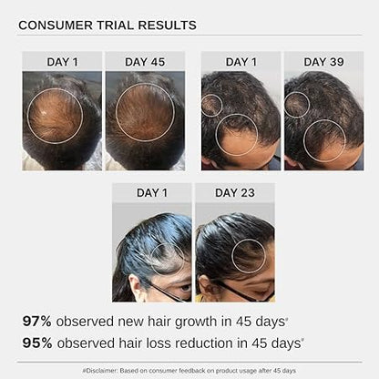 Bare Anatomy Advanced Hair Growth Serum